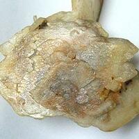 Baryte